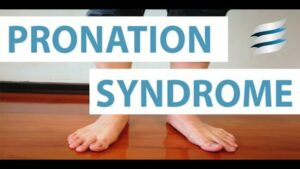 Your feet Your Hips Whats the connection Pronation Distortion Syndrome